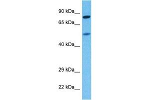 Host:  Rabbit  Target Name:  KCNC4  Sample Tissue:  Human 786-0 Whole Cell  Antibody Dilution:  1ug/ml (Kv3.4 anticorps  (N-Term))