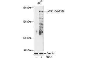 Western blot analysis of extracts of HeLa cells, using Phospho-TBC1D4-S588 antibody (ABIN7270747) at 1:2000 dilution.