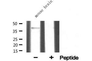 Western blot analysis of extracts from mouse brian, using SGCA antibody. (SGCA anticorps  (Internal Region))