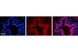 Rabbit Anti-SRPRB Antibody     Formalin Fixed Paraffin Embedded Tissue: Human Bronchial Epithelial Tissue  Observed Staining: Cytoplasmic  Primary Antibody Concentration: 1:100  Other Working Concentrations: 1/600  Secondary Antibody: Donkey anti-Rabbit-Cy3  Secondary Antibody Concentration: 1:200  Magnification: 20X  Exposure Time: 0.