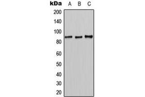 Western blot analysis of CLCN7 expression in HeLa (A), mouse liver (B), rat liver (C) whole cell lysates.