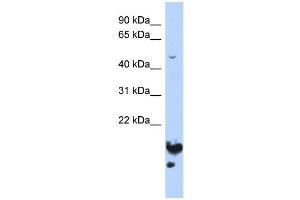 WB Suggested Anti-NUSAP1 Antibody Titration:  0. (NUSAP1 anticorps  (Middle Region))
