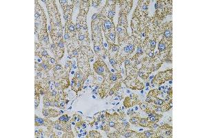 Immunohistochemistry of paraffin-embedded human liver injury using EPO antibody. (EPO anticorps)