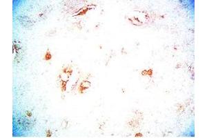 Rat brain tissue was stained by Rabbit Anti-CB2 Receptor (323-360) Serum (CNR2 anticorps  (AA 323-360))