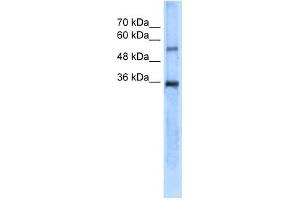 Carbonic Anhydrase VIII antibody used at 5 ug/ml to detect target protein. (CA8 anticorps  (N-Term))