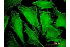 Immunofluorescence of monoclonal antibody to CDC42BPB on HeLa cell. (CDC42BPB anticorps  (AA 1580-1679))