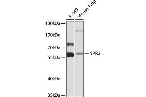 Western blot analysis of extracts of various cell lines, using NPR3 antibody (ABIN6133449, ABIN6144785, ABIN6144786 and ABIN6224163) at 1:1000 dilution. (NPR3 anticorps  (AA 272-541))