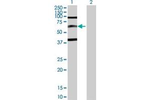 Western Blot analysis of SP110 expression in transfected 293T cell line by SP110 MaxPab polyclonal antibody. (SP110 anticorps  (AA 1-547))