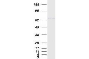 Validation with Western Blot