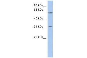 C1ORF110 antibody used at 1 ug/ml to detect target protein. (C1ORF110 anticorps  (Middle Region))