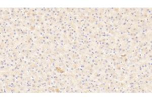 Detection of AMFR in Human Liver Tissue using Polyclonal Antibody to Autocrine Motility Factor Receptor (AMFR) (AMFR anticorps  (AA 456-643))