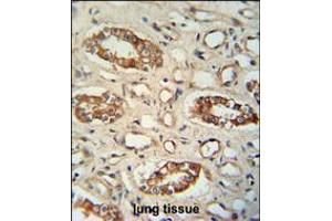 PPM1L antibody immunohistochemistry analysis in formalin fixed and paraffin embedded human lung tissue followed by peroxidase conjugation of the secondary antibody and DAB staining. (PPM1L anticorps  (C-Term))