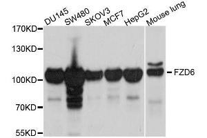Western blot analysis of extracts of various cell lines, using FZD6 antibody. (FZD6 anticorps  (AA 19-201))