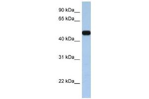 SLC25A46 antibody used at 1 ug/ml to detect target protein. (SLC25A46 anticorps  (C-Term))