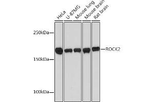Western blot analysis of extracts of various cell lines, using ROCK2 Rabbit mAb (ABIN7269972) at 1:1000 dilution. (ROCK2 anticorps)