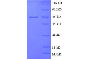 Tumor Necrosis Factor (TNF) (AA 78-234) protein (GST tag)