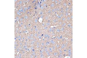 Immunohistochemistry of paraffin-embedded mouse brain using STX1A Rabbit mAb (ABIN7270684) at dilution of 1:100 (40x lens).