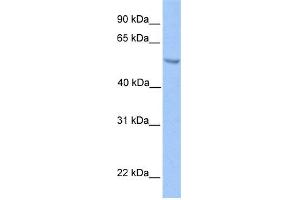 WB Suggested Anti-ETV5 Antibody Titration:  0. (ETV5 anticorps  (N-Term))