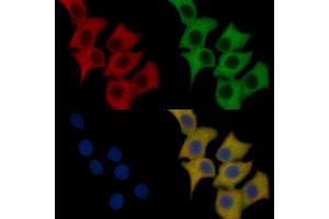 Flt3/CD135 Mouse Monoclonal Antibody staining HepG2 cells by IF/ICC. (FLT3 anticorps  (C-Term))