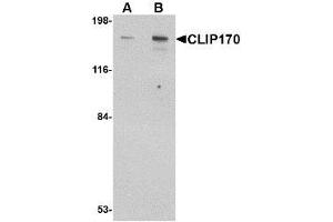 Image no. 1 for anti-CAP-GLY Domain Containing Linker Protein 1 (CLIP1) (C-Term) antibody (ABIN1492177) (CLIP1 anticorps  (C-Term))