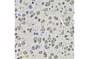 Immunohistochemistry of paraffin-embedded rat brain using PDIA6 Antibody (ABIN5974243) at dilution of 1/100 (40x lens). (PDIA6 anticorps)