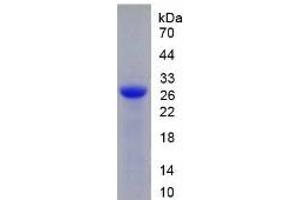 SDS-PAGE of Protein Standard from the Kit (Highly purified E. (DNASE1 Kit ELISA)