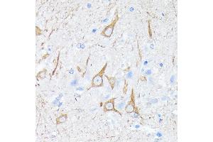 Immunohistochemistry of paraffin-embedded rat brain using Neurofilament H Rabbit mAb (ABIN7268866) at dilution of 1:100 (40x lens). (NEFH anticorps)