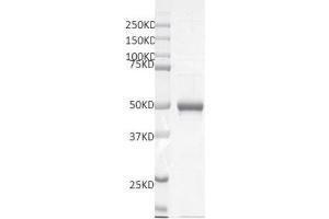 Recombinant SMYD5 protein gel.