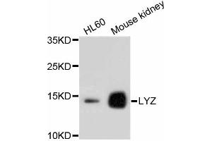 Western blot analysis of extracts of various cell lines, using LYZ antibody (ABIN4904274).