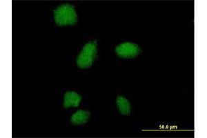 Immunofluorescence of purified MaxPab antibody to SMA4 on HeLa cell. (SMN1 anticorps  (AA 1-140))