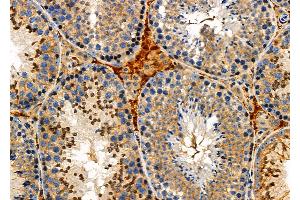 ABIN6259907 and ABIN6276919 at 1/100 staining Mouse testis tissue by IHC-P. (AMBP anticorps  (C-Term))
