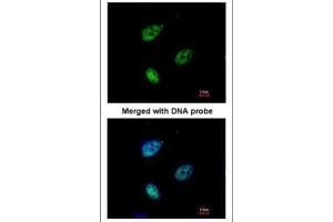 ICC/IF Image Immunofluorescence analysis of paraformaldehyde-fixed HeLa, using QIP1 , antibody at 1:200 dilution. (KPNA4 anticorps  (C-Term))