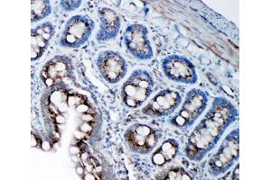 IHC-P: SSR3 antibody testing of rat intestine tissue (SSR3 anticorps  (AA 8-23))