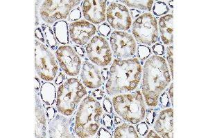 Immunohistochemistry of paraffin-embedded rat kidney using SNAPIN Rabbit pAb  at dilution of 1:200 (40x lens). (SNAPIN anticorps  (AA 1-136))