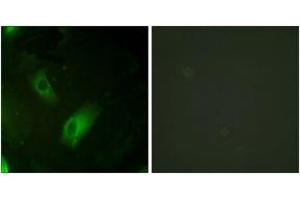 Immunofluorescence analysis of HeLa cells, using IREB1 (Ab-138) Antibody. (Aconitase 1 anticorps  (AA 106-155))