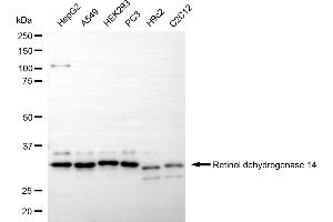 anti-Retinol Dehydrogenase 14 (All-Trans/9-Cis/11-Cis) (RDH14) antibody