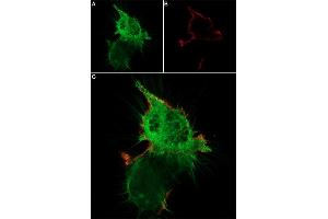 Live cell imaging of ω-Agatoxin IVA-ATTO Fluor-647N in differentiated  cells.