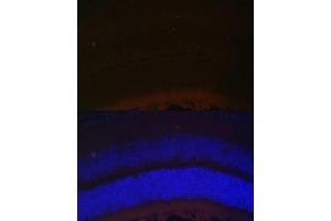 Immunofluorescence analysis of mouse retina using RDH5 Polyclonal Antibody (ABIN6130851, ABIN6146839, ABIN6146840 and ABIN6224076) at dilution of 1:100 (40x lens).