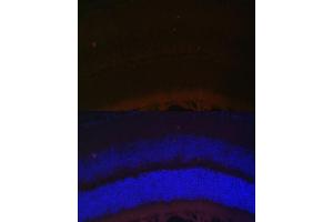 Immunofluorescence analysis of mouse retina using RDH5 Polyclonal Antibody (ABIN6130851, ABIN6146839, ABIN6146840 and ABIN6224076) at dilution of 1:100 (40x lens). (RDH5 anticorps  (AA 24-318))