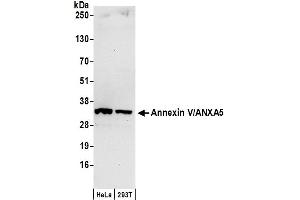 Western Blotting (WB) image for anti-Annexin A5 (ANXA5) (AA 1-50) antibody (ABIN7453029)