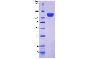 SDS-PAGE analysis of Rat GBP4 Protein. (GBP4 Protéine)