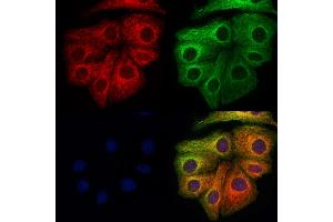 ABIN6265995 and ABIN6273344 staining Hela cells by IF/ICC. (VPS11 anticorps  (Internal Region))