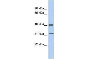 WB Suggested Anti-YBX1 Antibody Titration:  0. (YBX1 anticorps  (Middle Region))