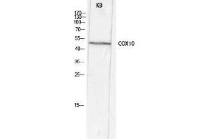 Western Blot (WB) analysis of KB lysis using COX10 antibody. (COX10 anticorps  (Internal Region))