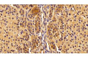 Detection of NFkB in Porcine Adrenal gland Tissue using Polyclonal Antibody to Nuclear Factor Kappa B (NFkB)