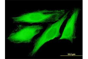 Immunofluorescence of purified MaxPab antibody to TUBB4Q on HeLa cell. (TUBB7P anticorps  (AA 1-434))