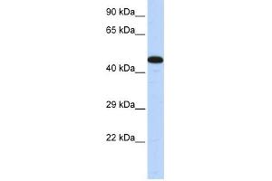 AKAP5 antibody used at 1 ug/ml to detect target protein. (AKAP5 anticorps)