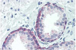 Human Prostate (formalin-fixed, paraffin-embedded) stained with FOXO3 antibody ABIN461993 at 1:100 followed by biotinylated goat anti-rabbit IgG secondary antibody ABIN481713, alkaline phosphatase-streptavidin and chromogen. (FOXO3 anticorps  (pThr24, Thr32))