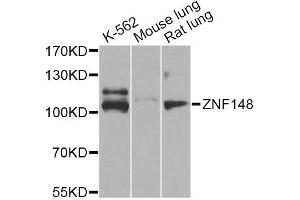 Western blot analysis of extracts of various cell lines, using ZNF148 Antibody (ABIN5974210) at 1/1000 dilution. (ZNF148 anticorps)