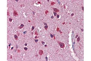 Immunohistochemistry (IHC) image for anti-Neuregulin 3 (NRG3) (Middle Region) antibody (ABIN2781935)